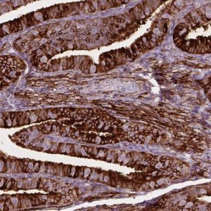 Anti-TM6SF2 antibody produced in rabbit 