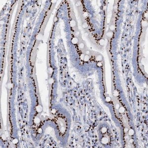 Anti-TM9SF3 antibody produced in rabbit 