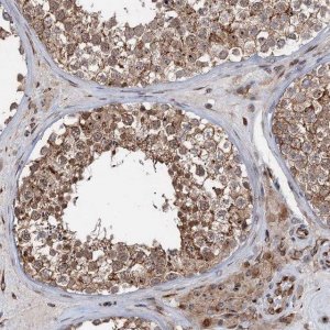 Anti-TMA16 antibody produced in rabbit HPA041571-100UL