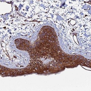Anti-TMC2 antibody produced in rabbit 