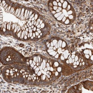 Anti-TMC7 antibody produced in rabbit 