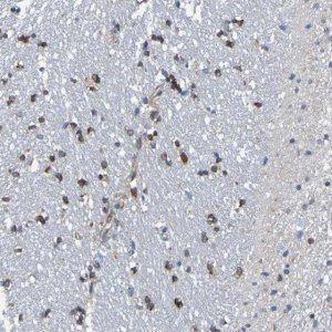 Anti-TMCC3 antibody produced in rabbit 