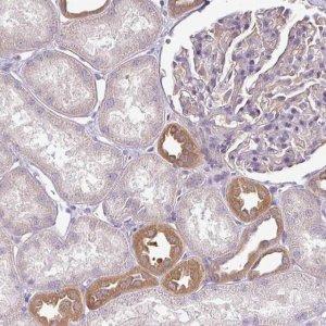 Anti-TMEM107 antibody produced in rabbit 