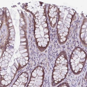 Anti-TMEM108 antibody produced in rabbit 