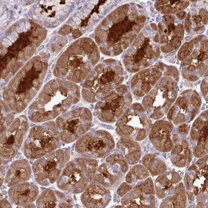 Anti-TMEM110 antibody produced in rabbit 