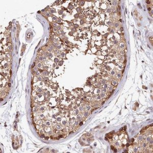 Anti-TMEM116 antibody produced in rabbit HPA040720-100UL