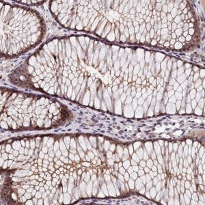 Anti-TMEM116 antibody produced in rabbit HPA040720-100UL
