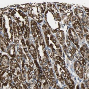 Anti-TMEM120B antibody produced in rabbit 
