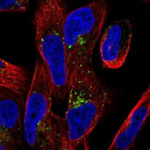 Anti-TMEM123 antibody produced in rabbit 