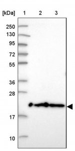 Anti-TMEM126A antibody produced in rabbit 
