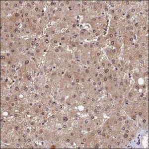 Anti-TMEM127 antibody produced in rabbit HPA042359-100UL