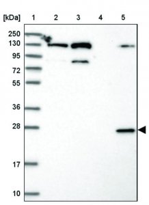 Anti-TMEM127 antibody produced in rabbit HPA042359-100UL