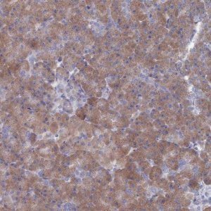 Anti-TMEM128 antibody produced in rabbit 