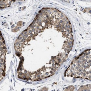 Anti-TMEM131 antibody produced in rabbit 
