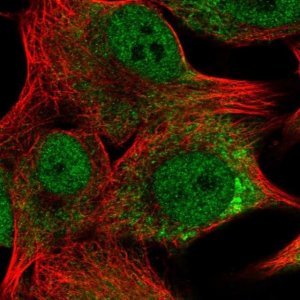 Anti-TMEM14A antibody produced in rabbit 