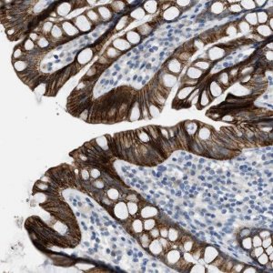 Anti-TMEM154 antibody produced in rabbit 