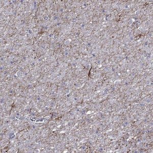 Anti-TMEM155 antibody produced in rabbit 