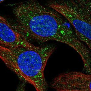 Anti-TMEM159 antibody produced in rabbit 