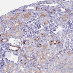 Anti-TMEM161B antibody produced in rabbit 