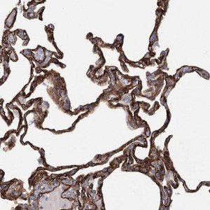Anti-TMEM164 antibody produced in rabbit 