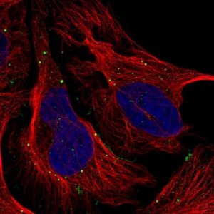 Anti-TMEM164 antibody produced in rabbit 