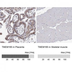 Anti-TMEM165 antibody produced in rabbit 