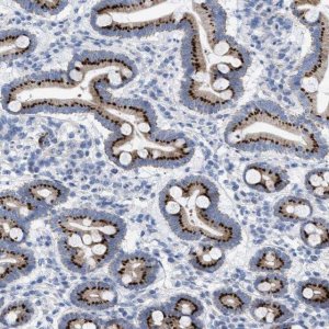 Anti-TMEM17 antibody produced in rabbit HPA018100-100UL