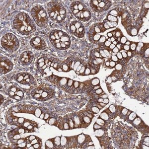 Anti-TMEM176B antibody produced in rabbit 