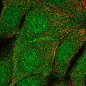 Anti-TMEM183A antibody produced in rabbit HPA072607-100UL