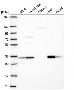 Anti-TMEM183A antibody produced in rabbit HPA072607-100UL