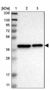 Anti-TMEM19 antibody produced in rabbit HPA016830-100UL
