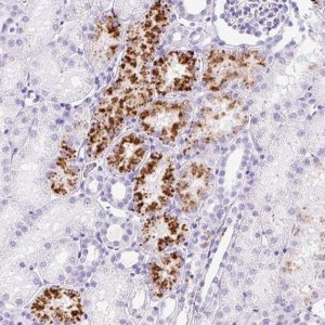 Anti-TMEM200B antibody produced in rabbit 