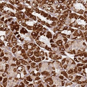 Anti-TMEM200C antibody produced in rabbit 