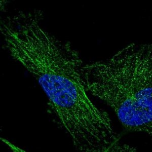 Anti-TMEM200C antibody produced in rabbit 