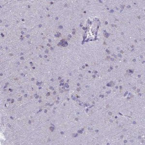 Anti-TMEM206 antibody produced in rabbit 