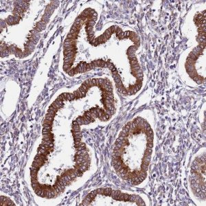 Anti-TMEM56 antibody produced in rabbit 
