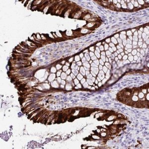 Anti-TMEM60 antibody produced in rabbit 