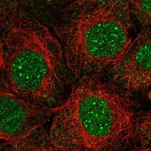 Anti-TMEM62 antibody produced in rabbit 