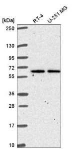 Anti-TMEM62 antibody produced in rabbit 