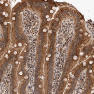 Anti-TMEM65 antibody produced in rabbit 