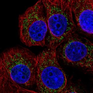 Anti-TMEM70 antibody produced in rabbit 