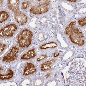 Anti-TMEM78 antibody produced in rabbit 
