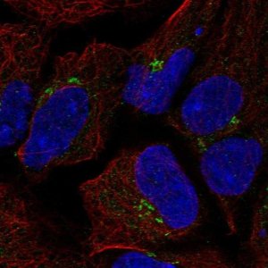 Anti-TMEM80 antibody produced in rabbit 