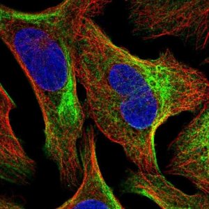 Anti-TMEM81 antibody produced in rabbit 