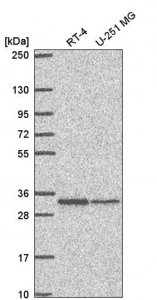 Anti-TMEM81 antibody produced in rabbit 