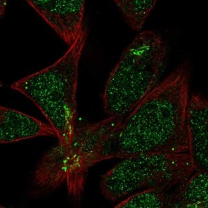 Anti-TMEM86A antibody produced in rabbit 
