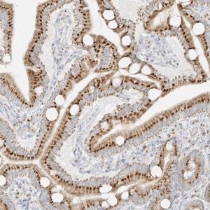 Anti-TMEM87B antibody produced in rabbit HPA035183-100UL