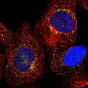 Anti-TMEM87B antibody produced in rabbit HPA035183-100UL