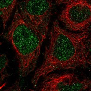 Anti-TMEM8A antibody produced in rabbit 