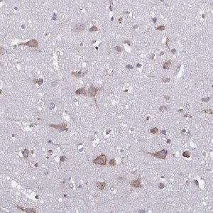 Anti-TMEM8C antibody produced in rabbit 